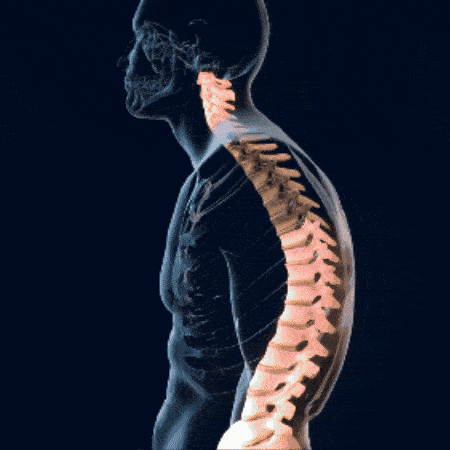 posture-corrector